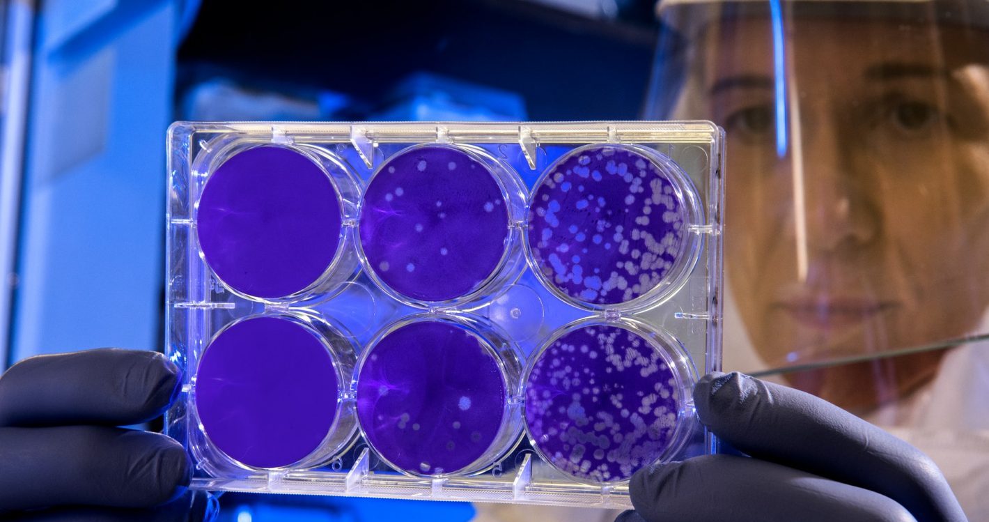 Person in a clear visor and medical protective clothing holding up a petri dish of samples