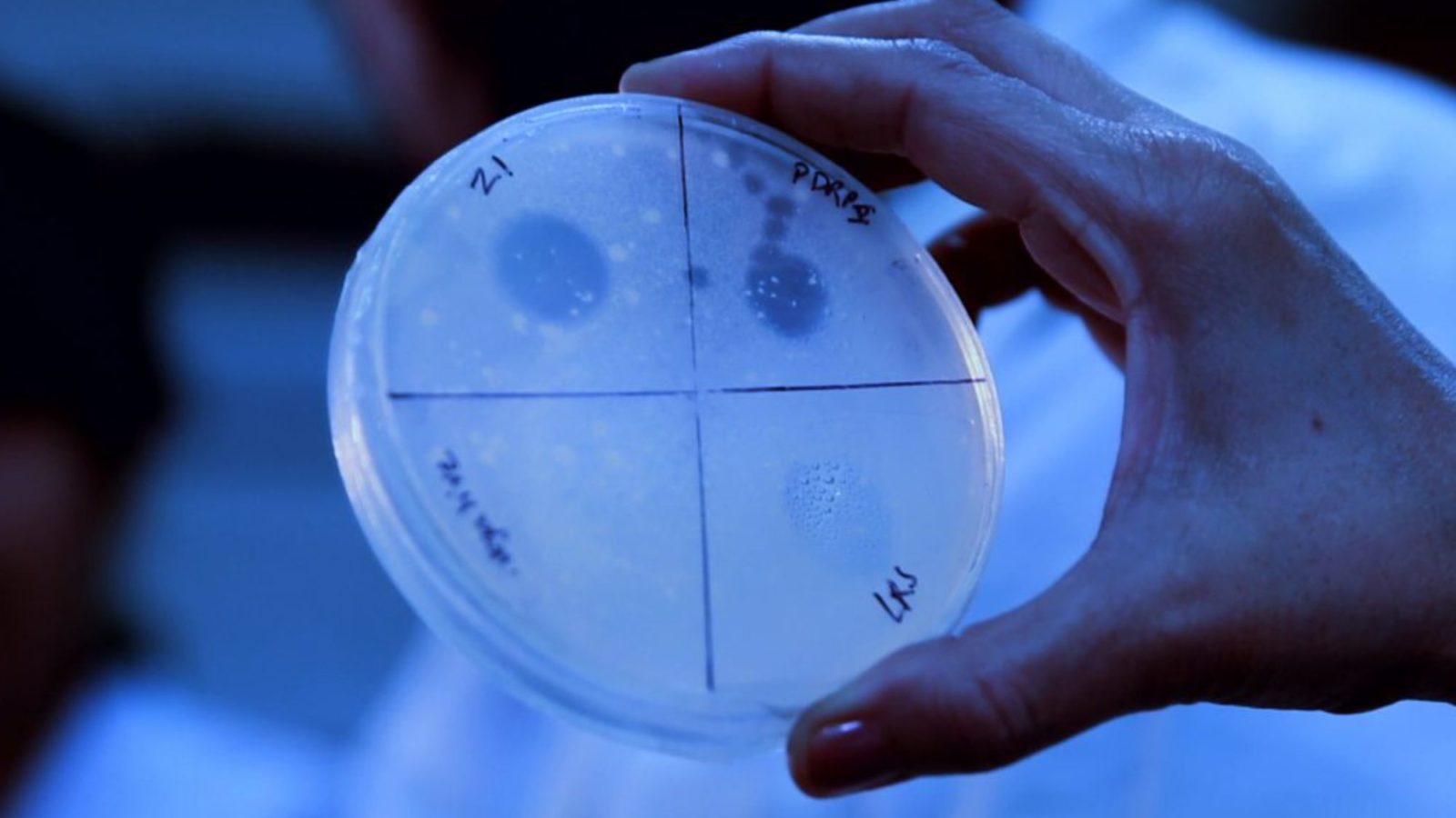 Hand holding a petri dish. Dish is divided into four sections with different growths in each