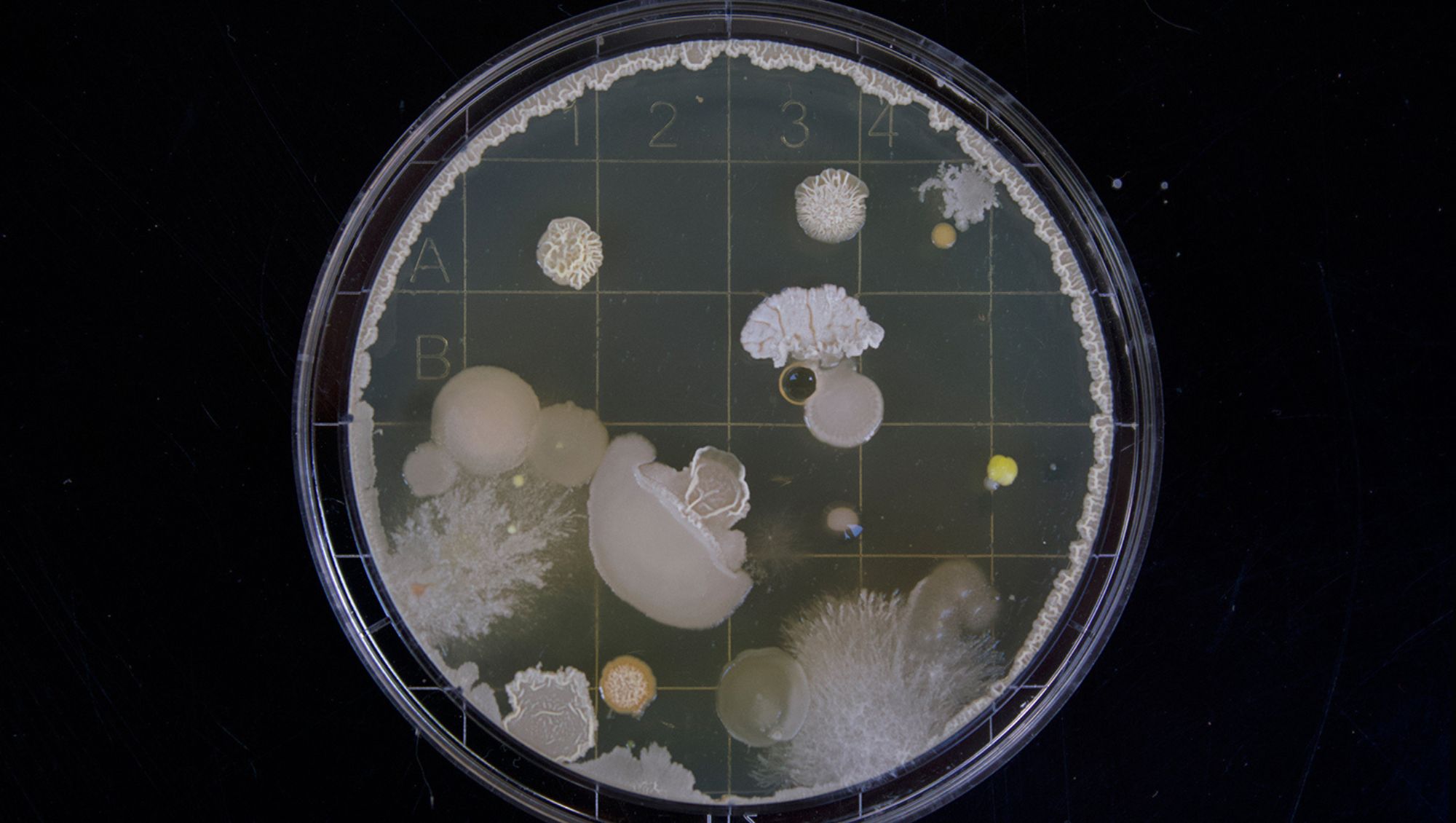 Petri dish culture