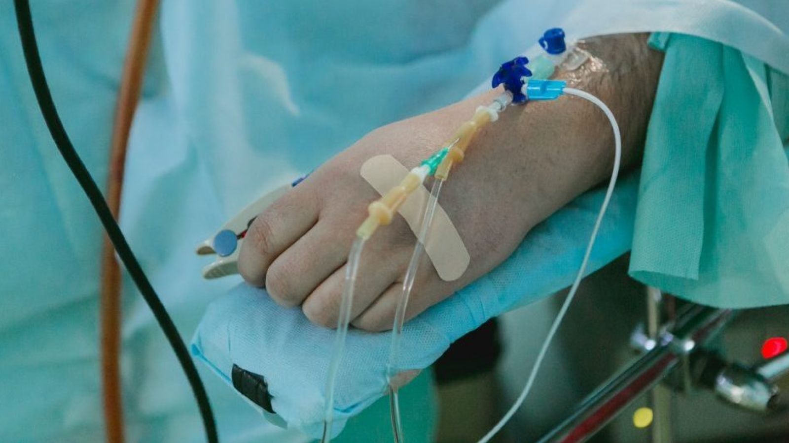 A hand with cannulas on an operating table covered with green sheets