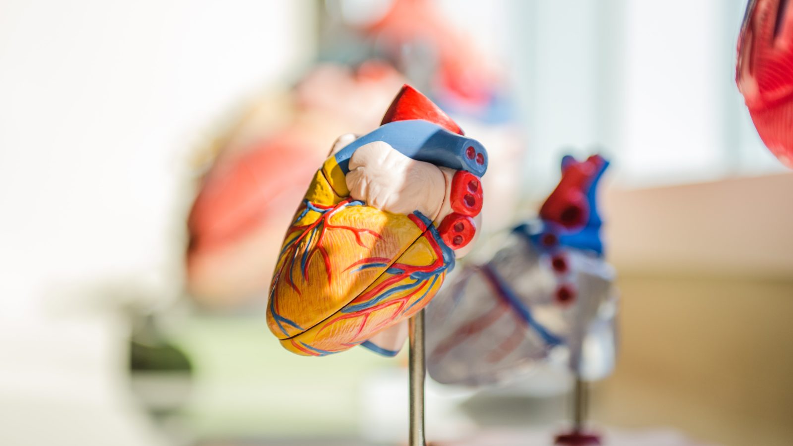 Anatomical heart model in yellow with blue and red blood vessels