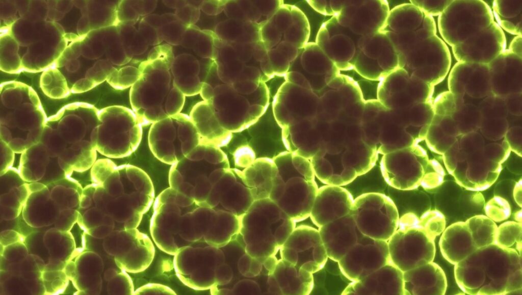Germs viewed through a microscope